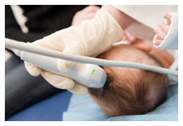 Doctor scans a baby's head